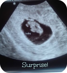 Ultrasound, Pregnancy, Surprise