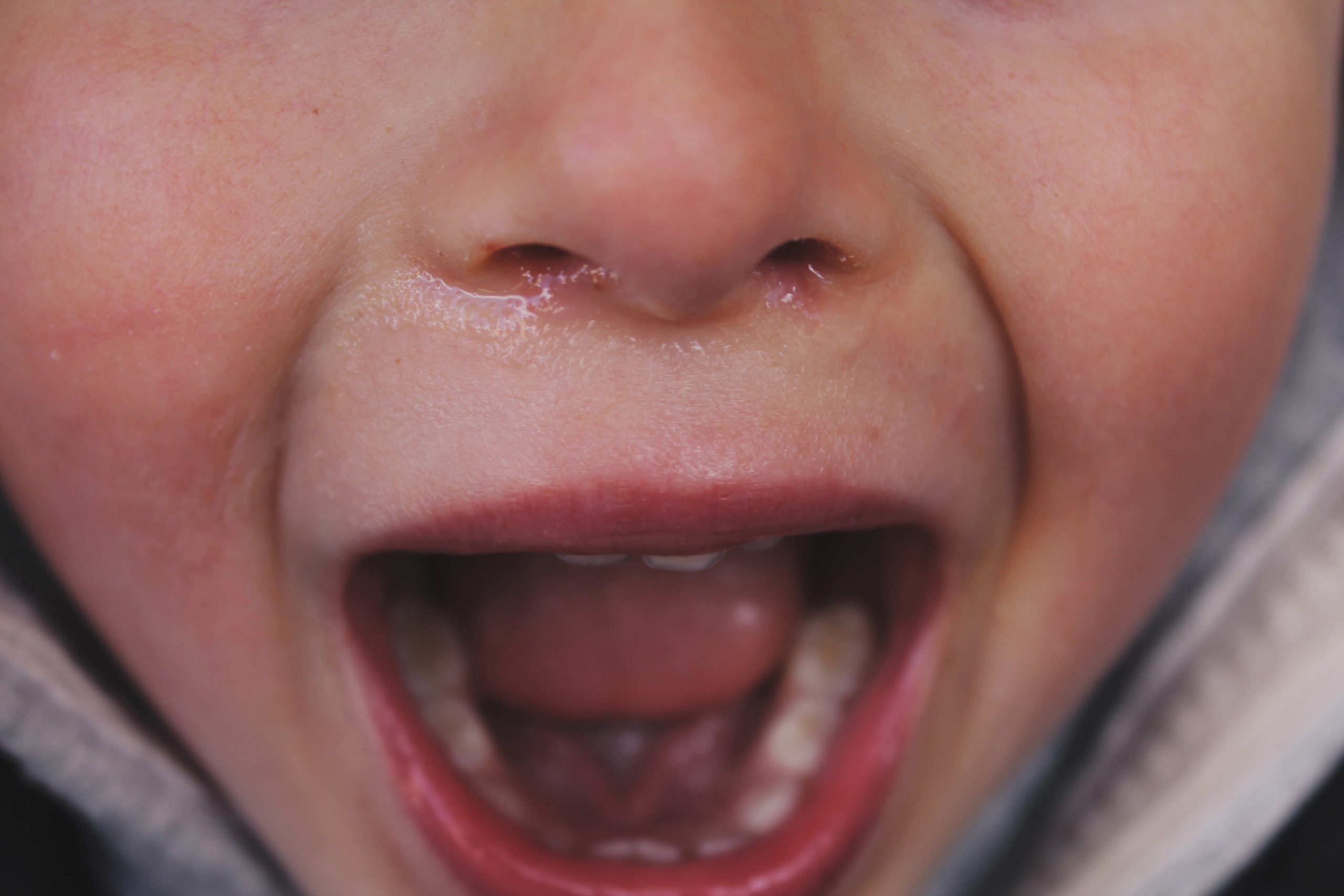 A child screams with an open mouth.